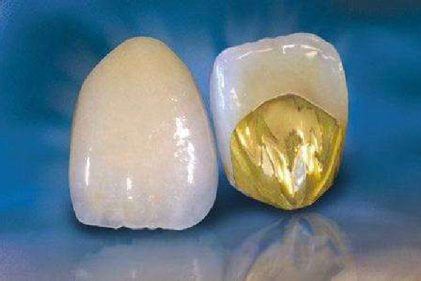 烤瓷牙做完多久能正常吃飯 烤瓷牙會疼嗎 烤瓷牙做完多久能正常吃飯 烤瓷牙會疼嗎