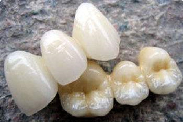 烤瓷牙有縫隙怎么修補(bǔ) 烤瓷牙出現(xiàn)黑線要換嗎 烤瓷牙有縫隙怎么修補(bǔ) 烤瓷牙出現(xiàn)黑線要換嗎