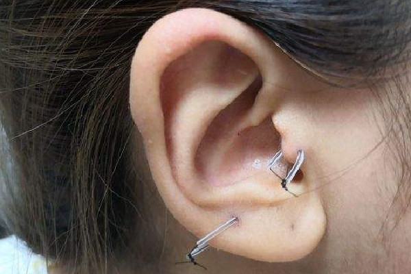打耳骨要多久恢復期 打耳骨釘之后多久可以換耳釘