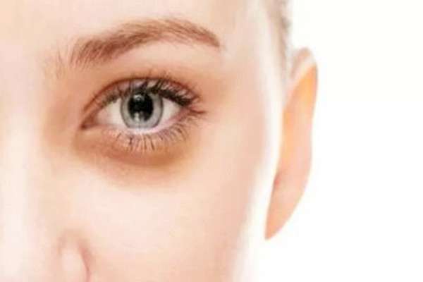 黑眼圈能用眼霜去掉嗎 黑眼圈能用遮瑕膏遮住嗎