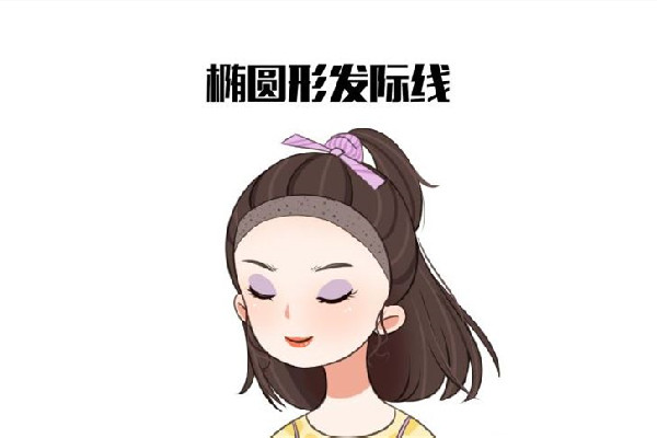 發(fā)際線后移怎么恢復 發(fā)際線后移是什么原因引起的 發(fā)際線后移怎么恢復 發(fā)際線后移是什么原因引起的