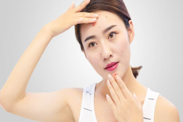 痘痘長(zhǎng)到多少歲 長(zhǎng)痘需要注意些什么 痘痘長(zhǎng)到多少歲 長(zhǎng)痘需要注意些什么