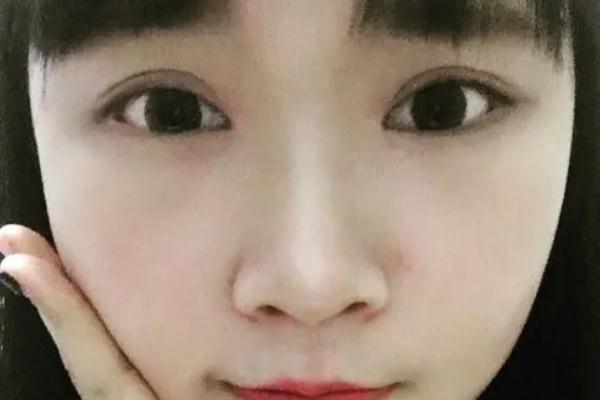 割雙眼皮會(huì)傷害眼睛嗎 割雙眼皮會(huì)割到眼部神經(jīng)嗎 割雙眼皮會(huì)傷害眼睛嗎 割雙眼皮會(huì)割到眼部神經(jīng)嗎