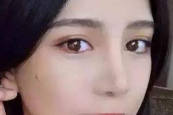 割雙眼皮是幾級(jí)疼痛 割雙眼皮要多長(zhǎng)時(shí)間完成 割雙眼皮是幾級(jí)疼痛 割雙眼皮要多長(zhǎng)時(shí)間完成