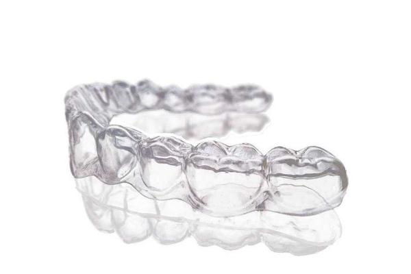 牙套什么年齡戴合適 牙套的作用是什么 牙套什么年齡戴合適 牙套的作用是什么