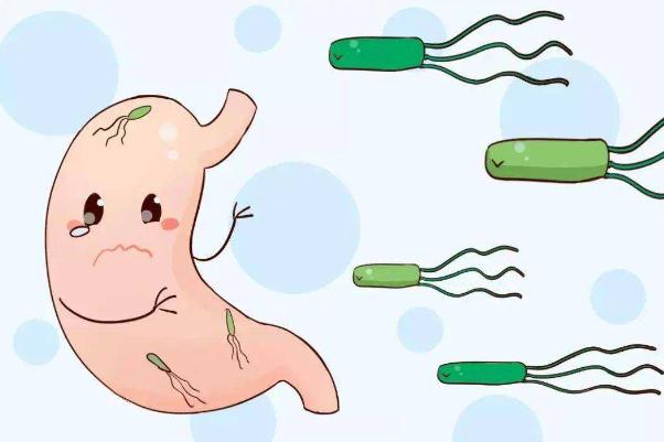感染幽門螺旋桿菌后有哪些癥狀 幽門螺旋桿菌是什么 感染幽門螺旋桿菌后有哪些癥狀 幽門螺旋桿菌是什么