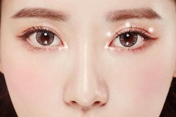 開眼角的回縮期是多久 開眼角是從哪個位置開 開眼角的回縮期是多久 開眼角是從哪個位置開