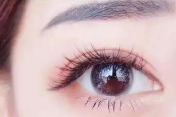 開眼角可以修復(fù)原樣嗎 開眼角可以做第二次嗎 開眼角可以修復(fù)原樣嗎 開眼角可以做第二次嗎