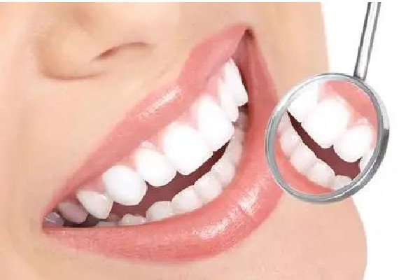 牙齒美白價格大概多少左右 牙齒美白去醫(yī)院掛什么科 牙齒美白價格大概多少左右 牙齒美白去醫(yī)院掛什么科