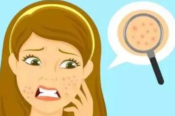 毛孔粗大要補(bǔ)水還是控油 毛孔粗大要不要用洗面奶 毛孔粗大要補(bǔ)水還是控油 毛孔粗大要不要用洗面奶