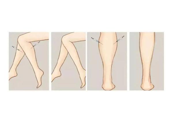 瘦腿針對脂肪腿有效果嗎 瘦腿針對身體有傷害嗎 瘦腿針對脂肪腿有效果嗎 瘦腿針對身體有傷害嗎