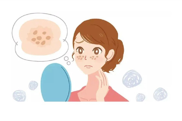 皮秒祛斑會有反黑的過程嗎 皮秒祛斑為什么會反黑 皮秒祛斑會有反黑的過程嗎 皮秒祛斑為什么會反黑