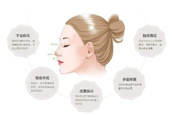 耳軟骨隆鼻耳朵會變形嗎 耳軟骨隆鼻耳朵疼幾天 耳軟骨隆鼻耳朵會變形嗎 耳軟骨隆鼻耳朵疼幾天