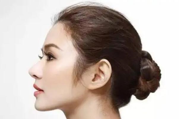 膨體隆鼻會(huì)移位嗎 膨體隆鼻會(huì)透光嗎 膨體隆鼻會(huì)移位嗎 膨體隆鼻會(huì)透光嗎