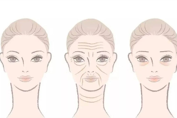 除皺針打哪個(gè)部位 除皺針可以打眼睛下面嗎 除皺針打哪個(gè)部位 除皺針可以打眼睛下面嗎