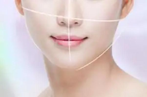 墊下巴痛不痛 墊下巴的效果 墊下巴痛不痛 墊下巴的效果