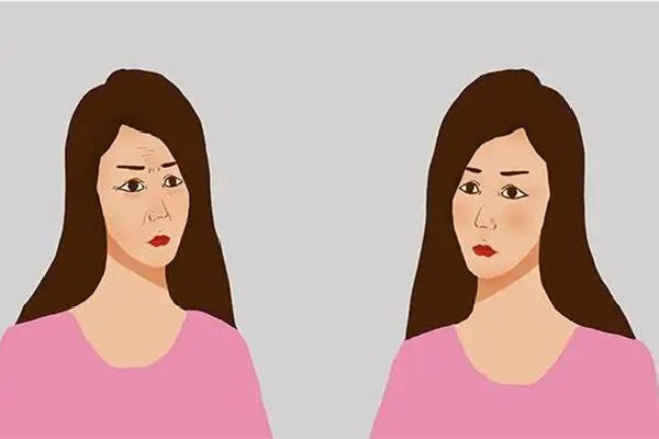 除皺針有哪幾種 除皺針要打幾次才能徹底沒有皺紋 除皺針有哪幾種 除皺針要打幾次才能徹底沒有皺紋