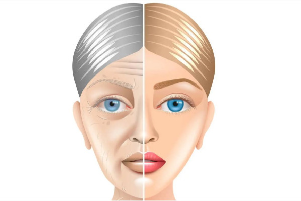 除皺針打哪個(gè)部位 除皺針可以打眼睛下面嗎 除皺針打哪個(gè)部位 除皺針可以打眼睛下面嗎