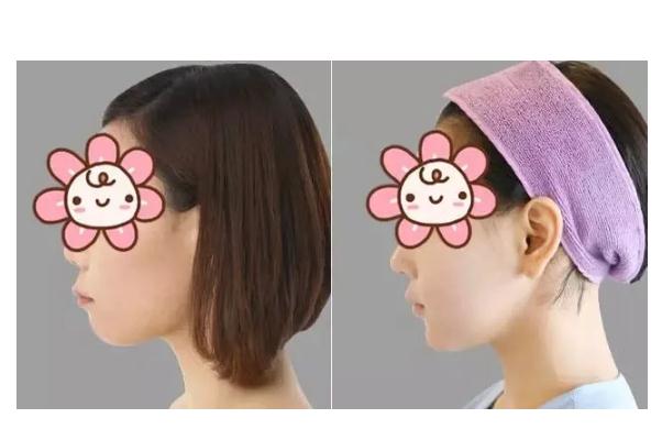 墊下巴可以用肋骨嗎 墊下巴可以改變臉型嗎 墊下巴可以用肋骨嗎 墊下巴可以改變臉型嗎