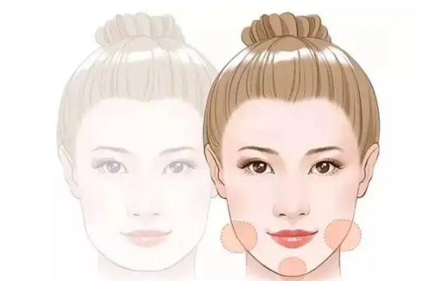 豐下巴是永久的嗎 豐下巴是從正面還是側面 豐下巴是永久的嗎 豐下巴是從正面還是側面