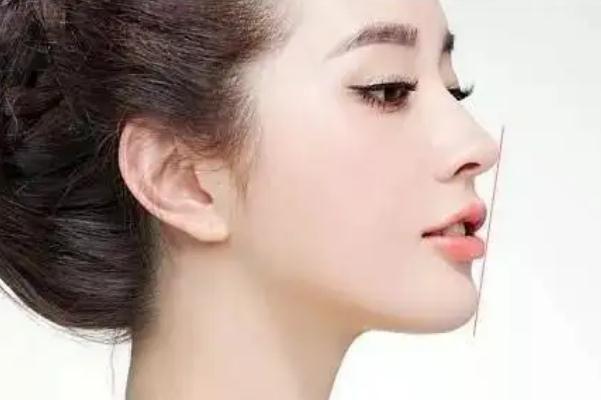 豐下巴哪種方法最好 豐下巴需要多少錢(qián) 豐下巴哪種方法最好 豐下巴需要多少錢(qián)