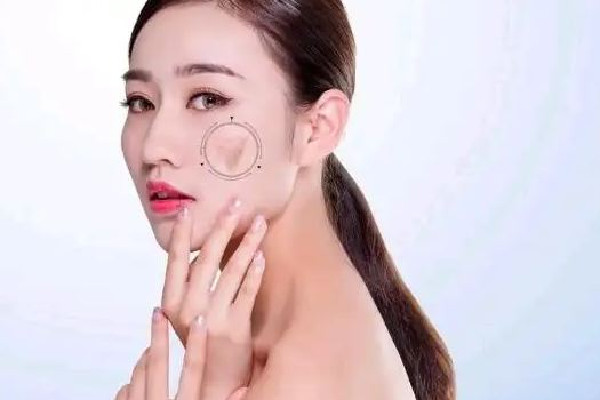 光子嫩膚一般多長時間做一次 光子嫩膚要做幾次有效 光子嫩膚一般多長時間做一次 光子嫩膚要做幾次有效