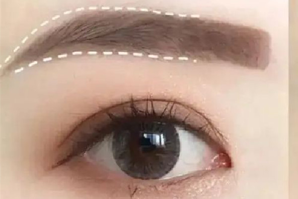 激光洗眉是第一次疼還是第二次疼 激光洗眉疼痛感多久消失 激光洗眉是第一次疼還是第二次疼 激光洗眉疼痛感多久消失