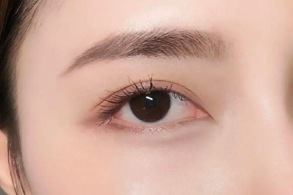 激光洗眉毛會(huì)不會(huì)留疤 激光洗眉幾天可以掉痂 激光洗眉毛會(huì)不會(huì)留疤 激光洗眉幾天可以掉痂