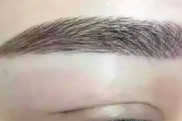 激光洗眉用不用刮眉毛 激光洗眉用什么機(jī)器最好 激光洗眉用不用刮眉毛 激光洗眉用什么機(jī)器最好