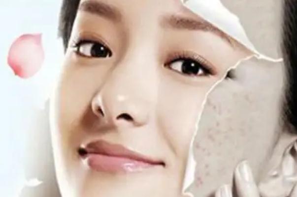 紅藍光祛痘是激光祛痘嗎 紅藍光祛痘和激光祛痘哪個好 紅藍光祛痘是激光祛痘嗎 紅藍光祛痘和激光祛痘哪個好