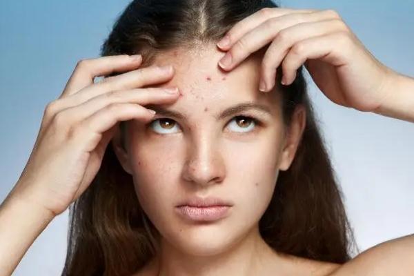 紅藍(lán)光祛痘的作用及副作用 紅藍(lán)光祛痘到底有沒有效果