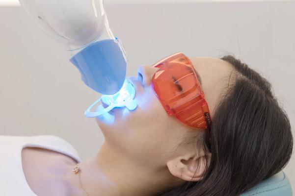 冷光美白牙齒要多少錢(qián)一次 冷光美白牙齒對(duì)牙齒有什么傷害 冷光美白牙齒要多少錢(qián)一次 冷光美白牙齒對(duì)牙齒有什么傷害