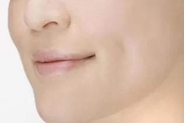 人造酒窩的價格 人造酒窩是不是一天比一天好 人造酒窩的價格 人造酒窩是不是一天比一天好