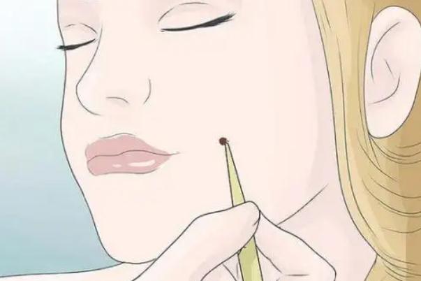 人造酒窩的價格 人造酒窩是不是一天比一天好 人造酒窩的價格 人造酒窩是不是一天比一天好