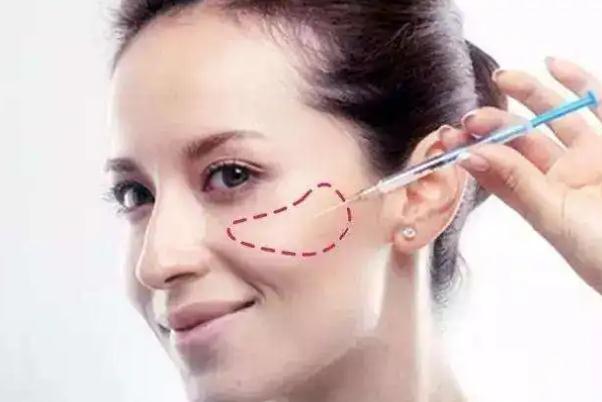 蘋果肌復位的注意事項 蘋果肌復位后要戴面罩嗎