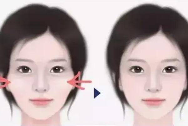 顴骨內(nèi)推要開刀嗎 顴骨內(nèi)推有生命危險嗎 顴骨內(nèi)推要開刀嗎 顴骨內(nèi)推有生命危險嗎