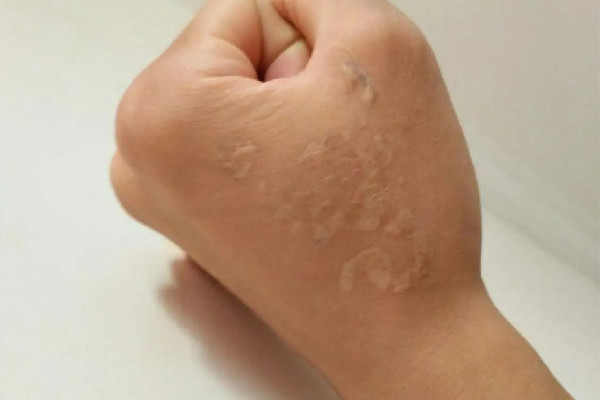 洗紋身敷麻藥嗎 洗紋身敷麻藥對(duì)人體有沒有傷害