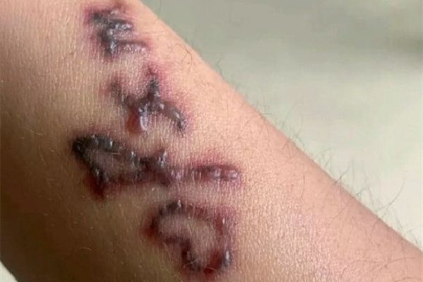 洗紋身會不會留疤 洗紋身后要注意什么 洗紋身會不會留疤 洗紋身后要注意什么