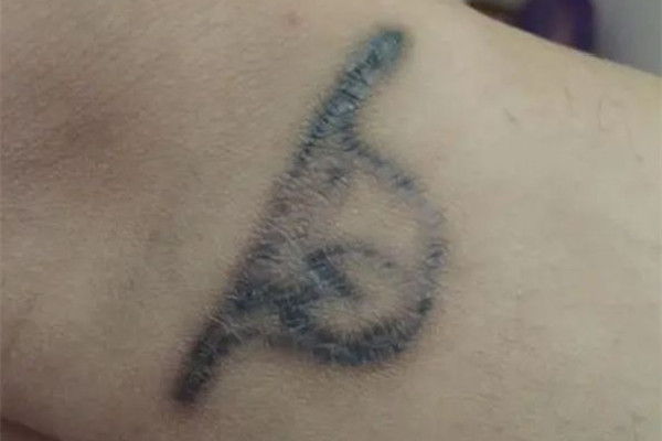 洗紋身敷麻藥嗎 洗紋身敷麻藥對(duì)人體有沒有傷害