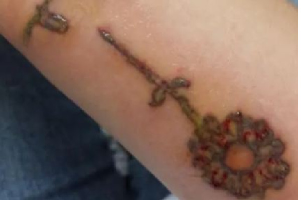 洗紋身用激光好還是皮秒好 洗紋身用什么洗最好 洗紋身用激光好還是皮秒好 洗紋身用什么洗最好