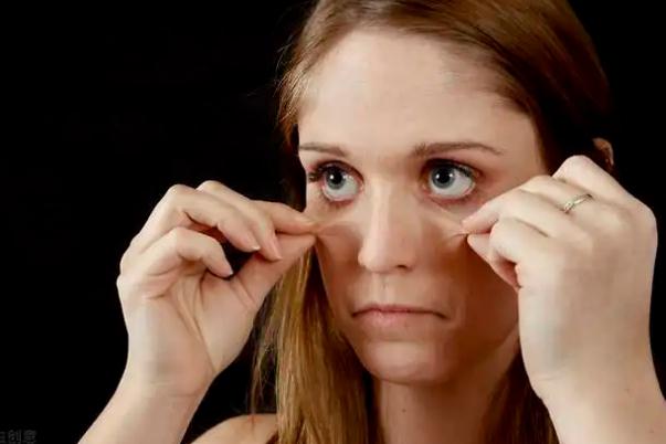 皮膚暗黃有痘印如何調理 皮膚暗黃有黑色素如何調理 皮膚暗黃有痘印如何調理 皮膚暗黃有黑色素如何調理