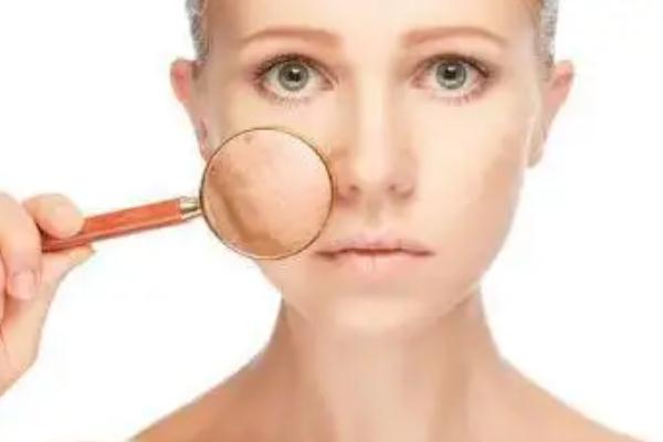 皮膚暗黃是缺少什么維生素 皮膚暗黃是天生的嗎 皮膚暗黃是缺少什么維生素 皮膚暗黃是天生的嗎