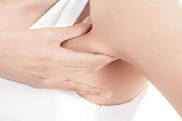 副乳切除手術(shù)是全麻還是局麻 副乳切除手術(shù)后多久可以正?；顒?dòng)