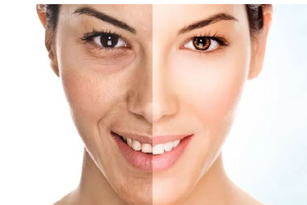 皮膚曬紅了應(yīng)該怎么處理 皮膚曬紅是曬傷了嗎 皮膚曬紅了應(yīng)該怎么處理 皮膚曬紅是曬傷了嗎