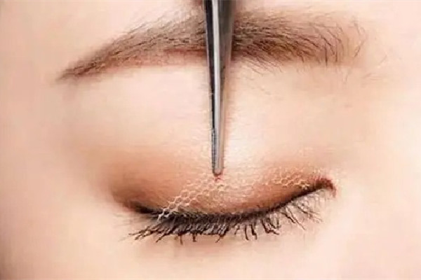 雙眼皮貼適合腫眼泡么 雙眼皮貼腫眼泡怎么貼 雙眼皮貼適合腫眼泡么 雙眼皮貼腫眼泡怎么貼