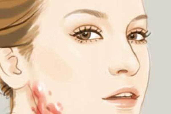 武漢哪個醫(yī)院去疤痕效果最好 武漢去疤痕是去醫(yī)院還是整形醫(yī)院 武漢哪個醫(yī)院去疤痕效果最好 武漢去疤痕是去醫(yī)院還是整形醫(yī)院