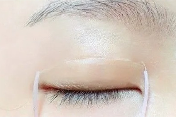 雙眼皮貼直接撕會(huì)怎樣 雙眼皮貼怎么取下來
