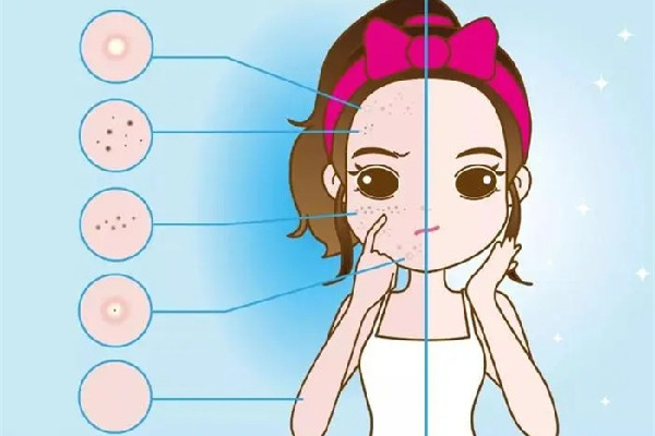 武漢哪家醫(yī)院皮膚科最好 武漢祛斑有哪些好地方 武漢哪家醫(yī)院皮膚科最好 武漢祛斑有哪些好地方