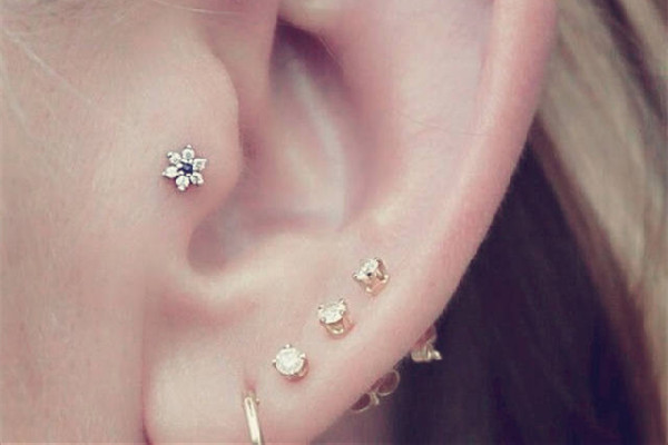 打耳洞增生疙瘩怎么辦 打耳洞為什么會長疙瘩 打耳洞增生疙瘩怎么辦 打耳洞為什么會長疙瘩