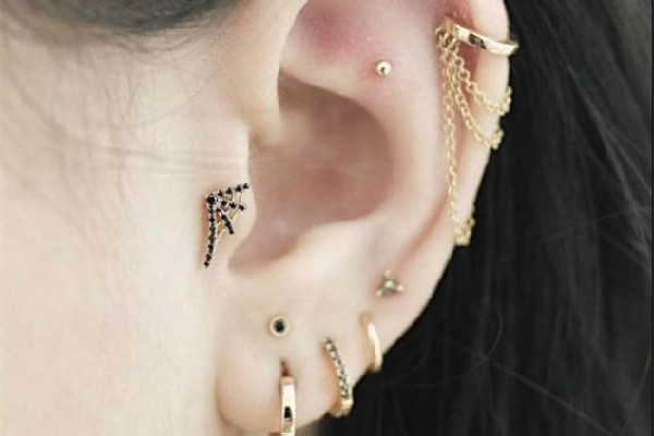 打耳洞增生疙瘩怎么辦 打耳洞為什么會長疙瘩 打耳洞增生疙瘩怎么辦 打耳洞為什么會長疙瘩